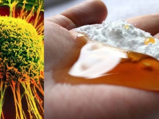 Xôn xao chuyện baking soda chữa được ung thư: Đâu là sự thật?